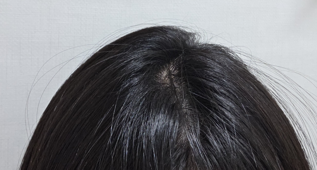 라보에이치 (LABO-H) 두피강화클리닉 앰플 토닉 review image