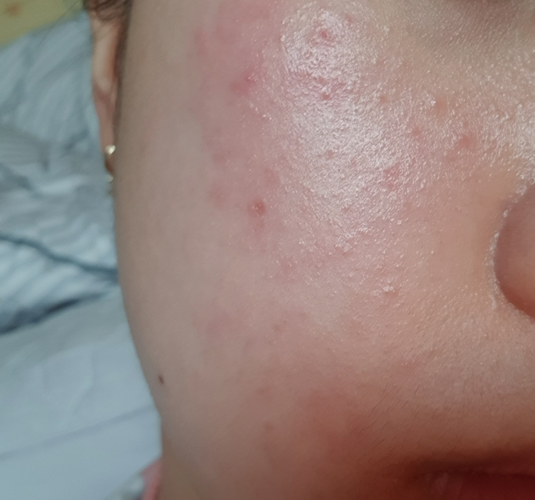 hidiff 皇家分层泡沫爽肤水 common.review image