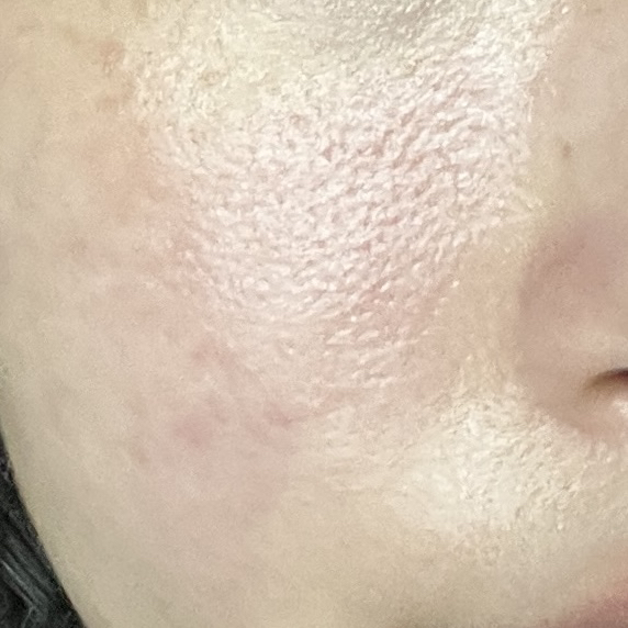6 肽护肤精华素的真实用户使用照片