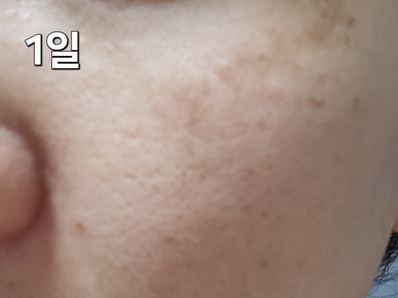 탈리다쿰 (TalithaKoum) HM+Barrier™ 화이트 단델리온 에센스 수 review image