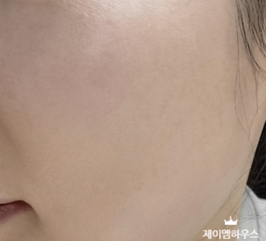 달바 (d'Alba) 글로우 핏 세럼 커버 쿠션 [SPF50+/PA++++] [21호] review image