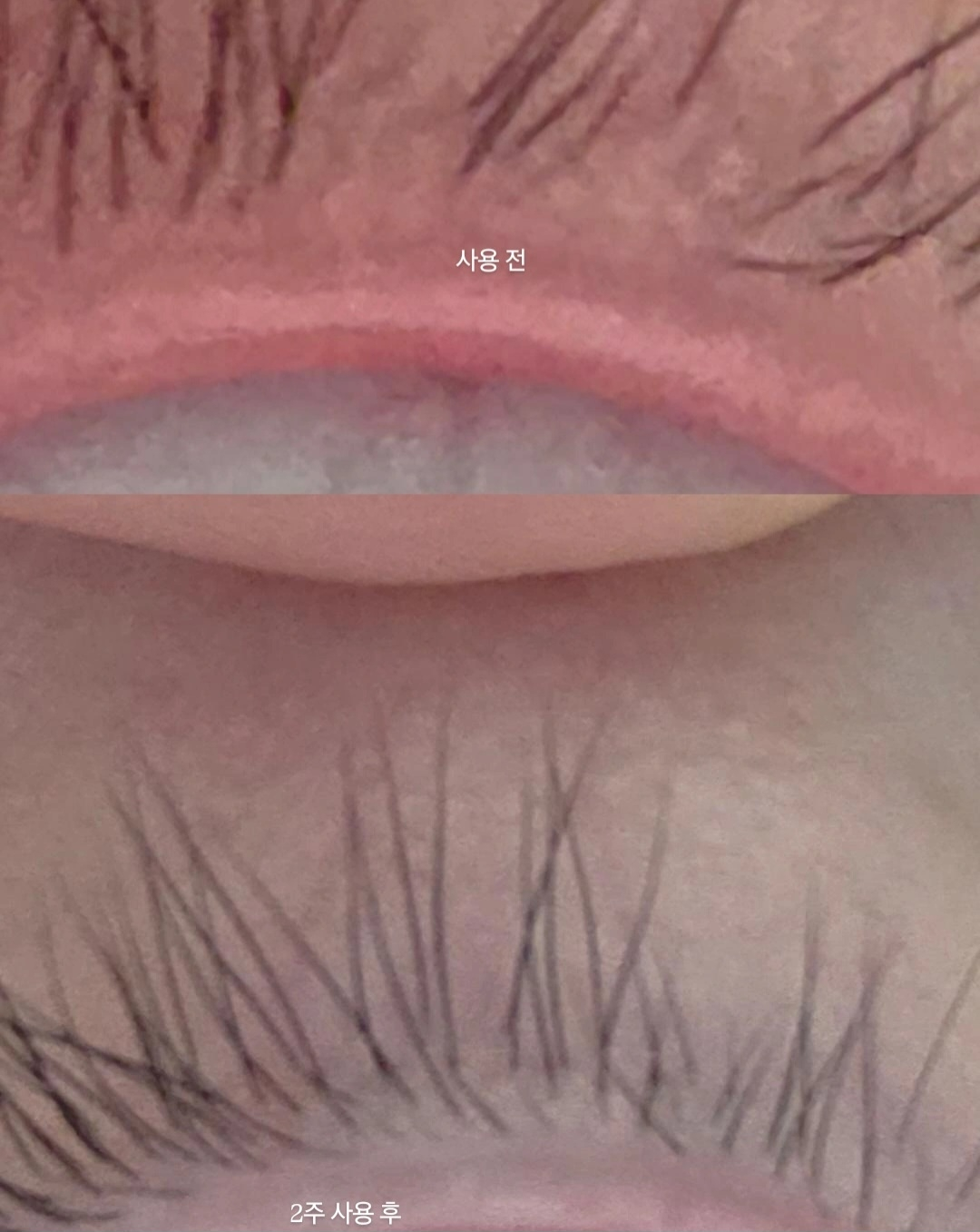 리필드 (Refilled) 사이토카인 아이래쉬 듀얼 앰플 review image