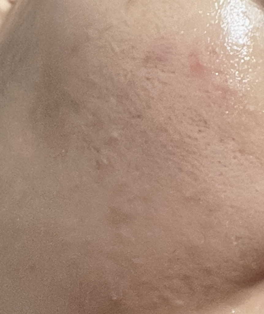 메디힐 (MEDIHEAL) 마데카소사이드 흔적 리페어 세럼 review image