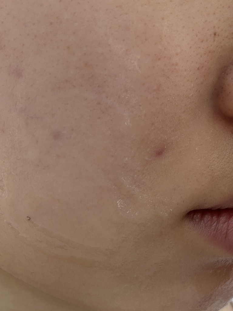 아이소이 (ISOI) 모이스춰 닥터 앰플 review image