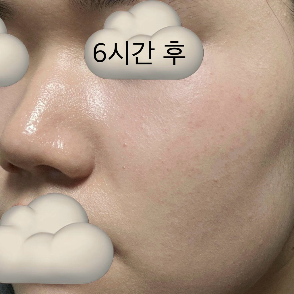 셀퓨전씨 (CellFusionC) 스킨 블레미쉬 밤 인텐시브 [21 내추럴 라이트] review image