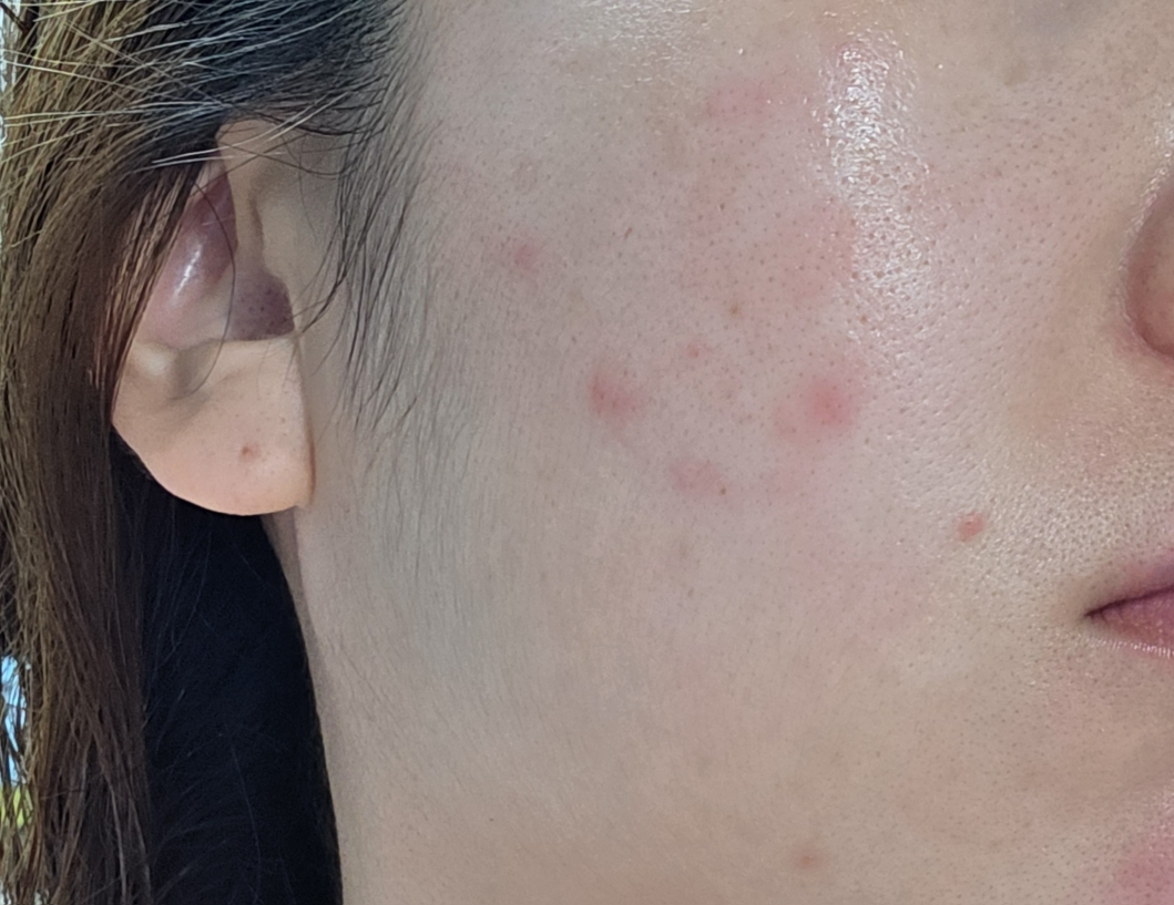아이소이 (ISOI) 모이스춰 닥터 크림 review image