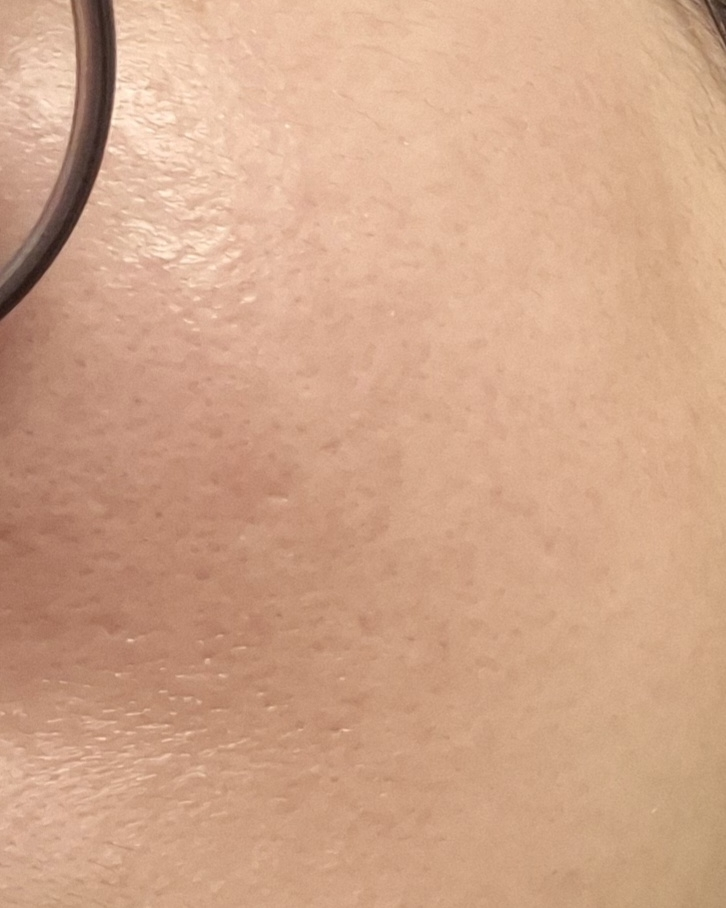 메디힐 (MEDIHEAL) 마데카소사이드 흔적 리페어 세럼 review image