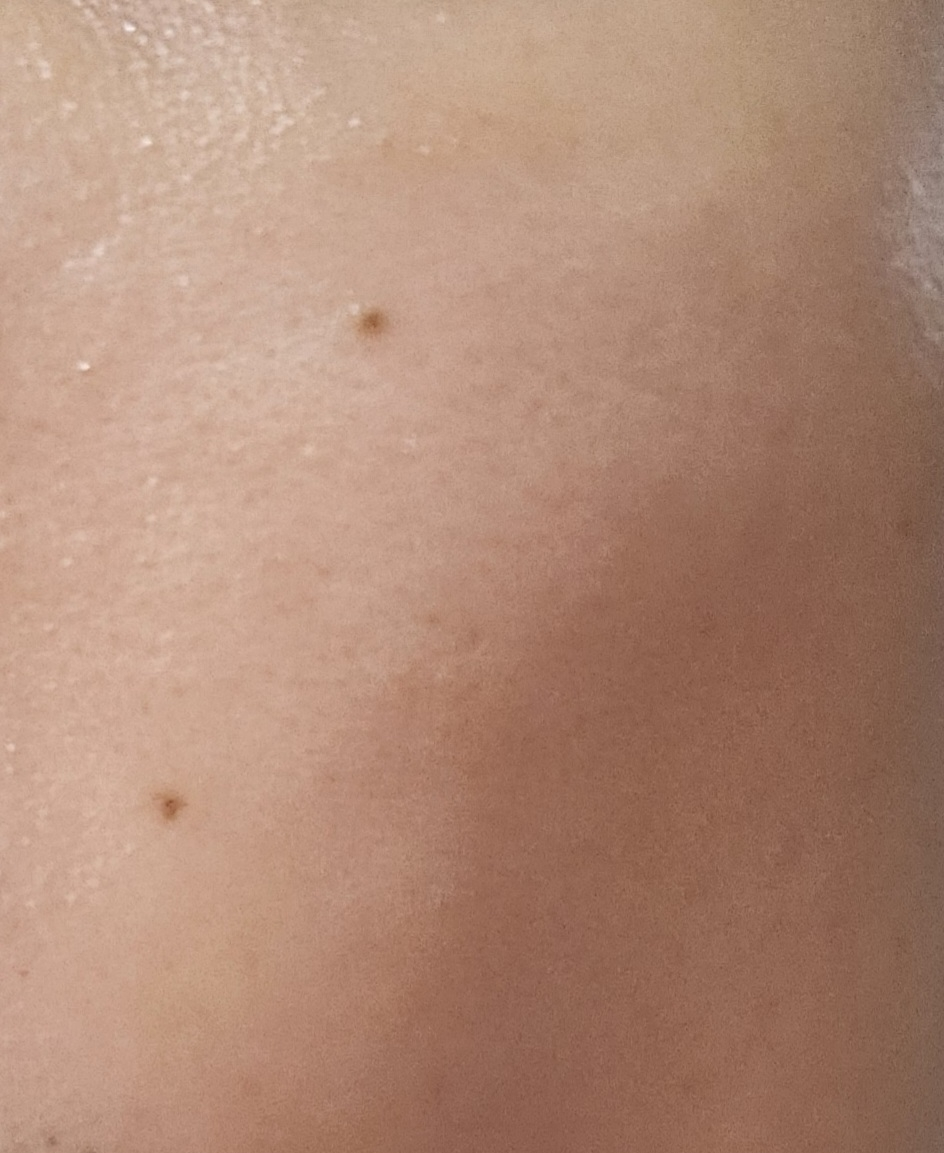 아이소이 (ISOI) 모이스춰 닥터 크림 review image