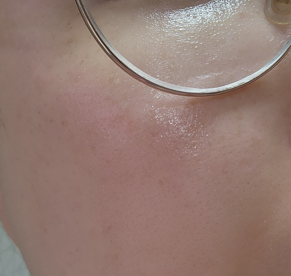 아누아 (Anua) PDRN 히알루론산 캡슐 100 세럼 마스크 review image