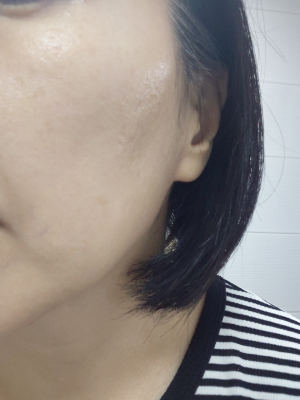 아누아 (Anua) PDRN 히알루론산 캡슐 100 세럼 review image