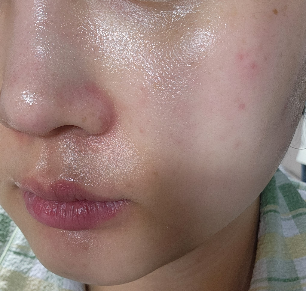 柔恩莱 松树精华安瓶 common.review image