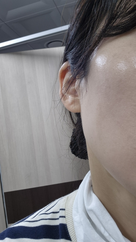 肌肤修复膏 集中修护 [21 自然亮]的真实用户使用照片