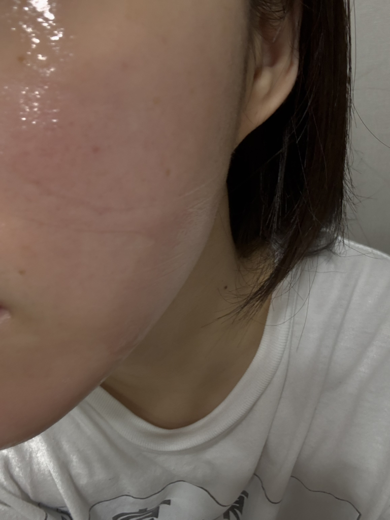 아렌시아 (ARENCIA) 레드 스무디 세럼 30 review image