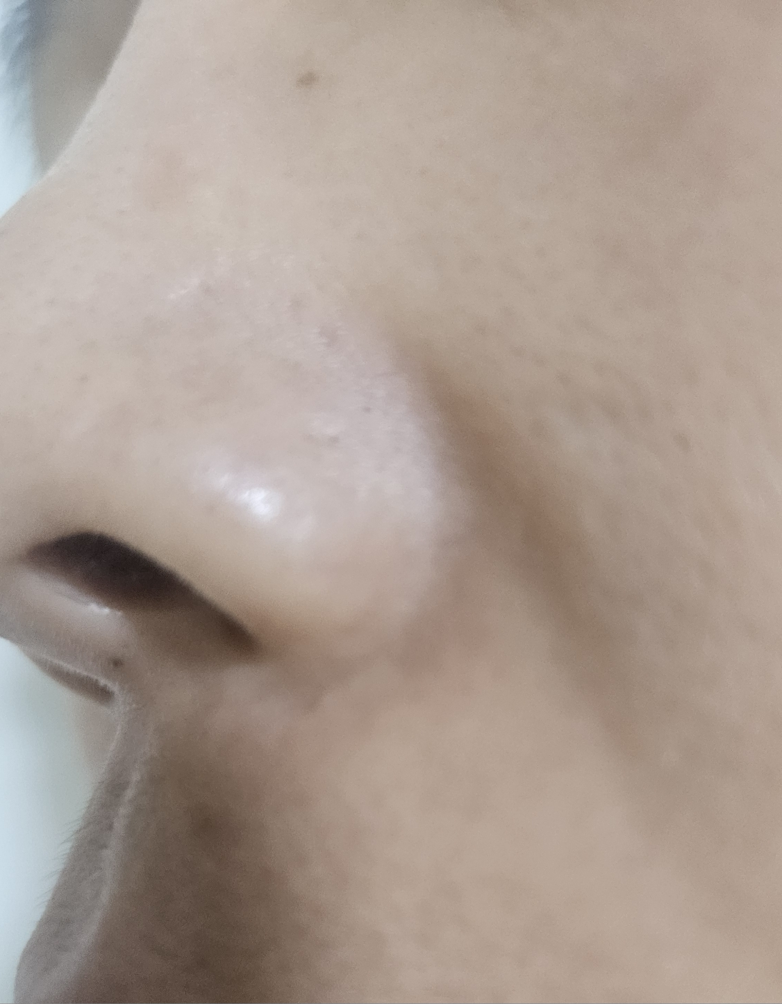 绿豆卸妆油的真实用户使用照片