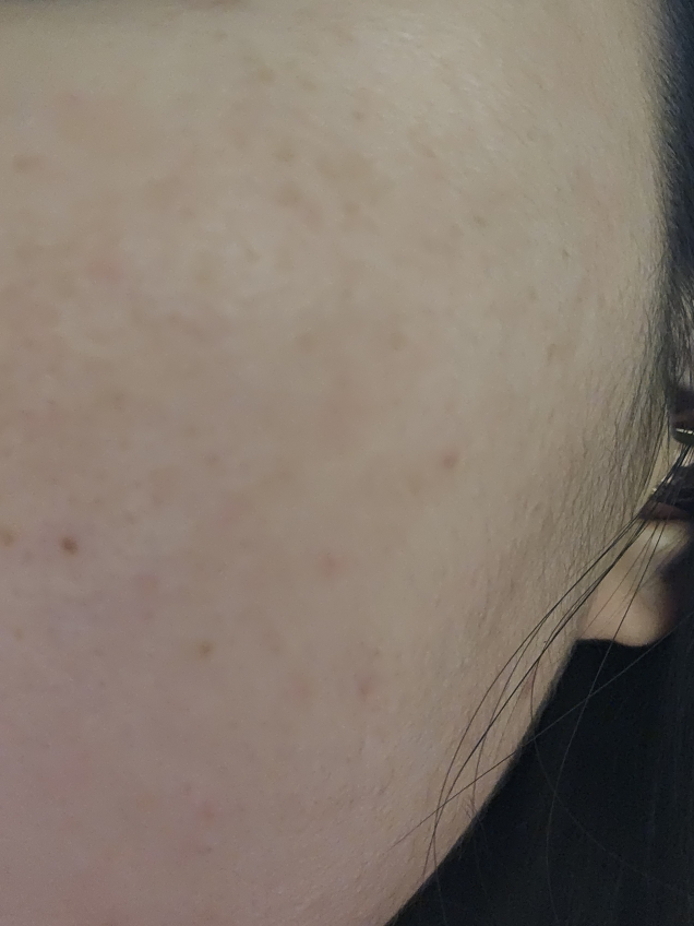 VitaCePlus BlemishCe 紧肤安瓶的真实用户使用照片