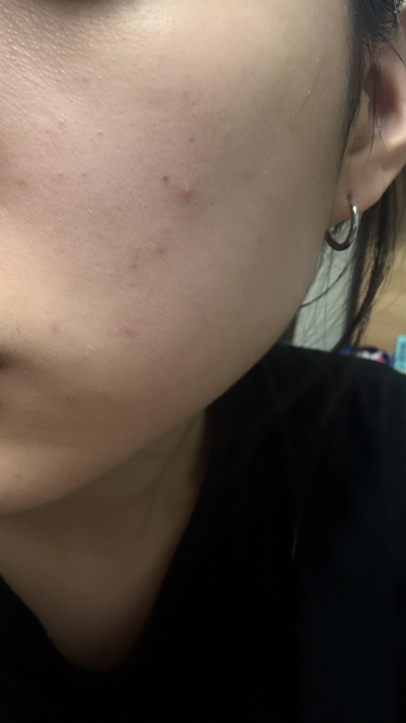 慢性衰老 PDRN 安瓿的真实用户使用照片