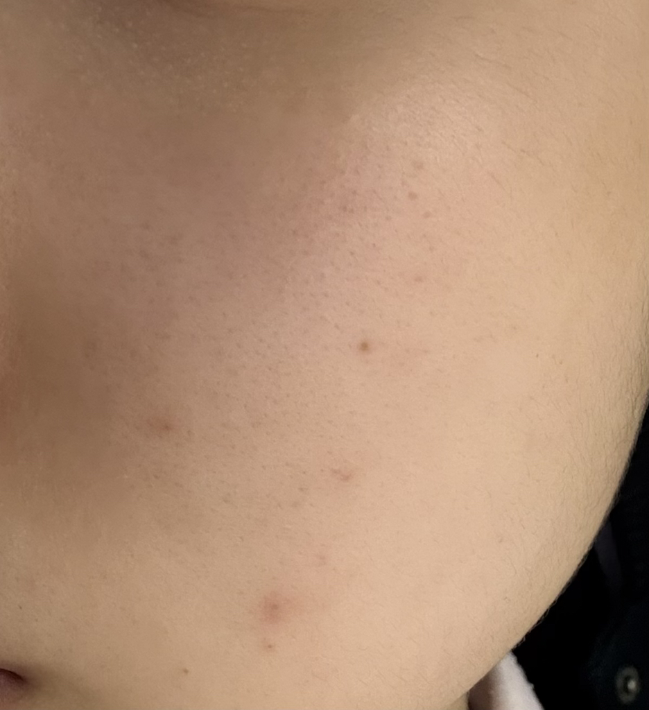 慢性衰老 PDRN 安瓿的真实用户使用照片