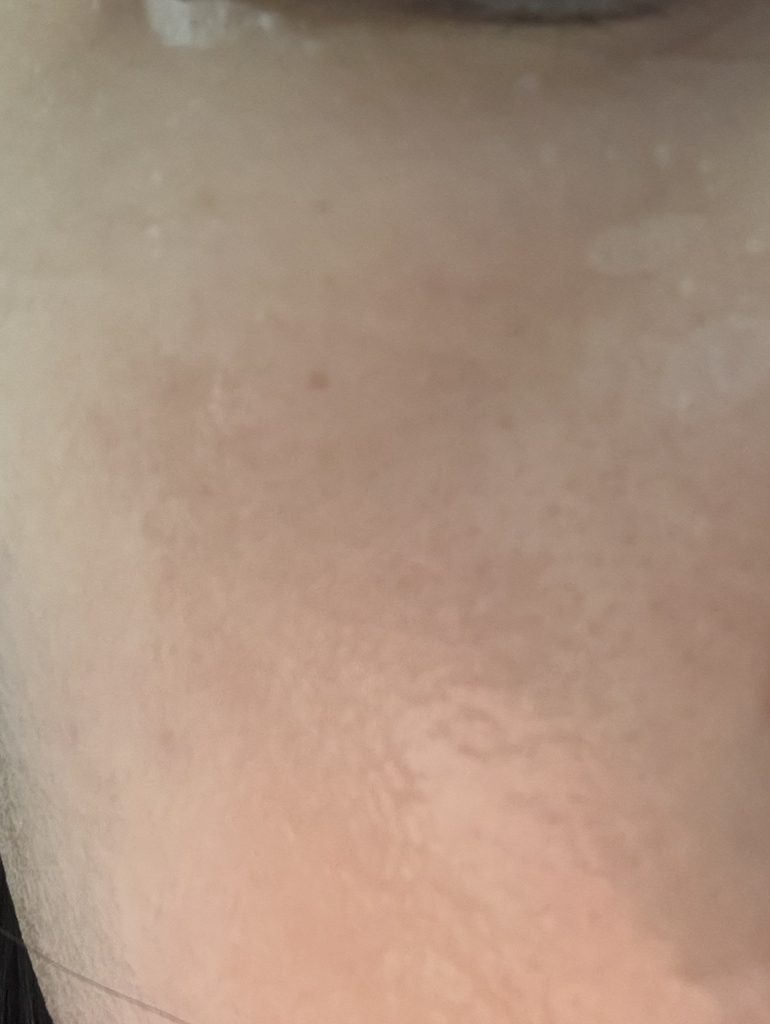 PDRN 玻尿酸胶囊 100 精华素面膜的真实用户使用照片