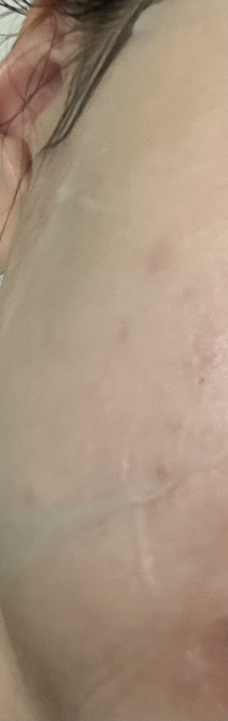 PDRN 玻尿酸胶囊 100 精华素面膜的真实用户使用照片