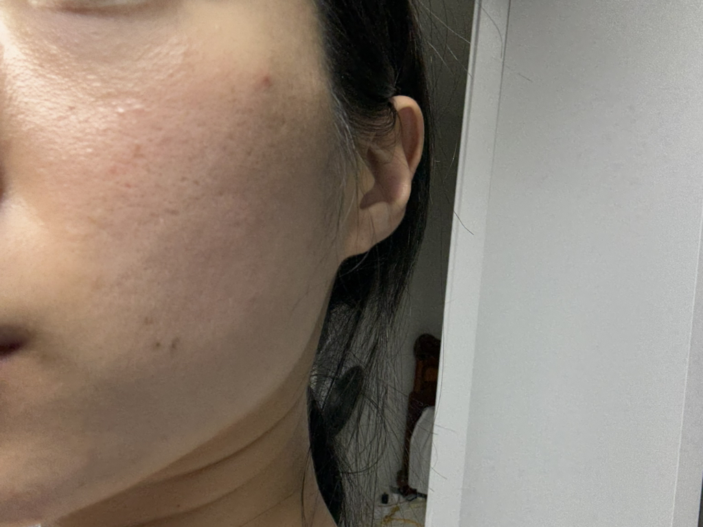 PDRN 玻尿酸胶囊 100 血清的真实用户使用照片