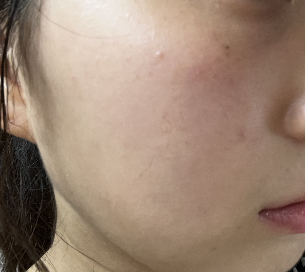无酒精粘液精华爽肤水的真实用户使用照片
