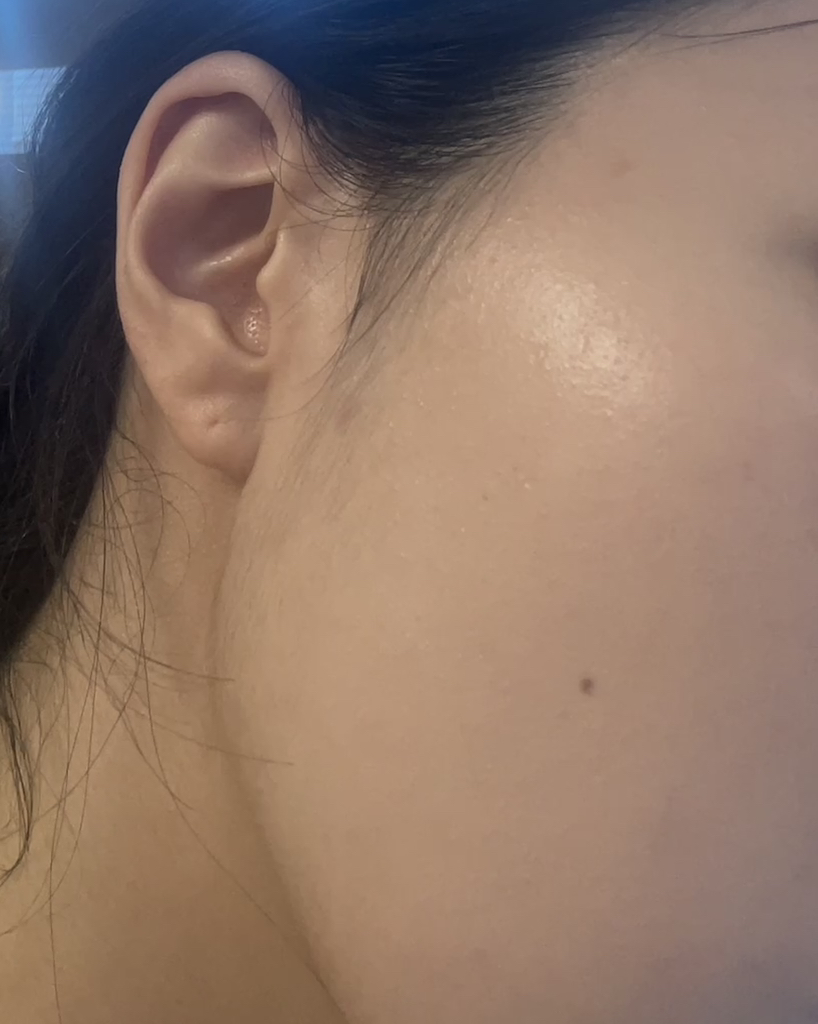 密集祛斑霜 [21 自然光]的真实用户使用照片