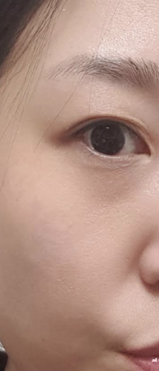 神经酰胺柚子生物清洁油的真实用户使用照片