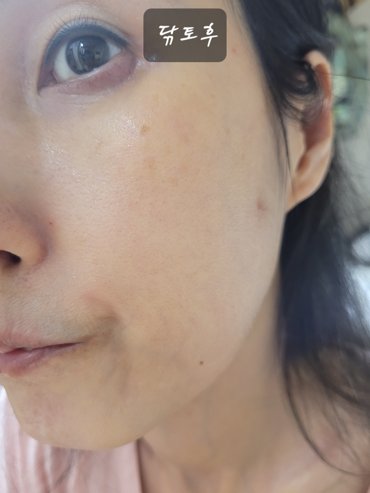 아누아 (Anua) PDRN 100 히알루론산 글로우 패드 review image