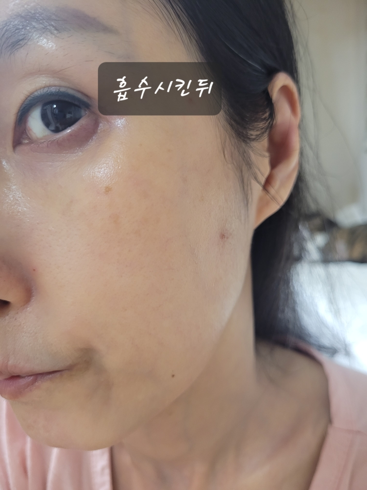 아누아 (Anua) PDRN 100 히알루론산 글로우 패드 review image