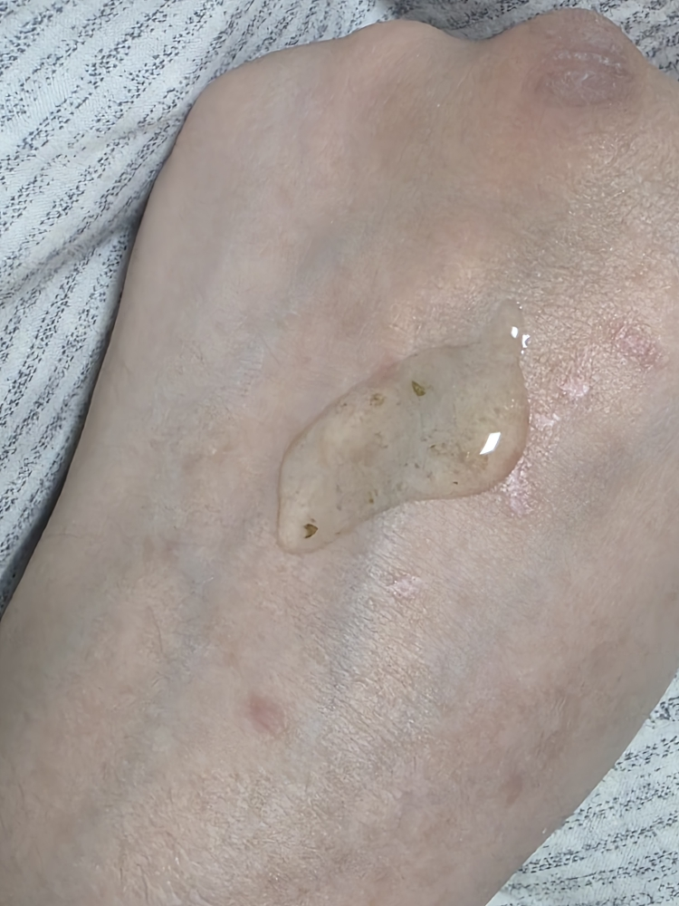希西卡姆安瓿的真实用户使用照片