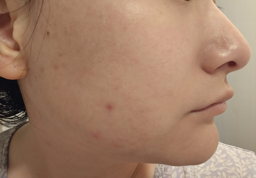 퓨어리카 (purelica) 퓨어 퍼펙션 허브쿨 패드 review image