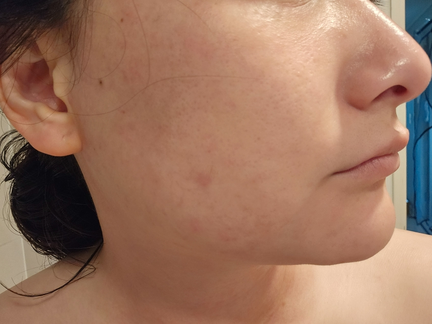 퓨어리카 (purelica) 퓨어 퍼펙션 허브쿨 패드 review image