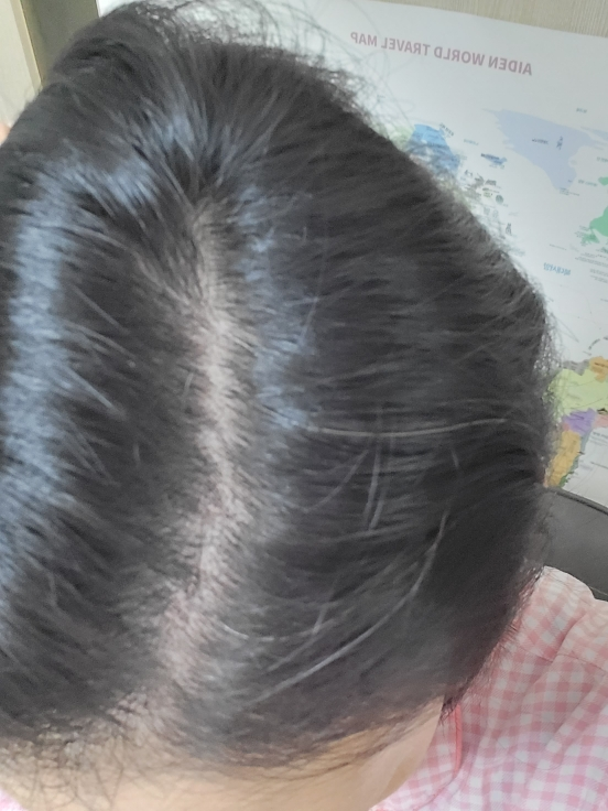 릴리이브 (lilyeve) 스칼프턴 시카 PDRN 딥클린 샴푸 review image