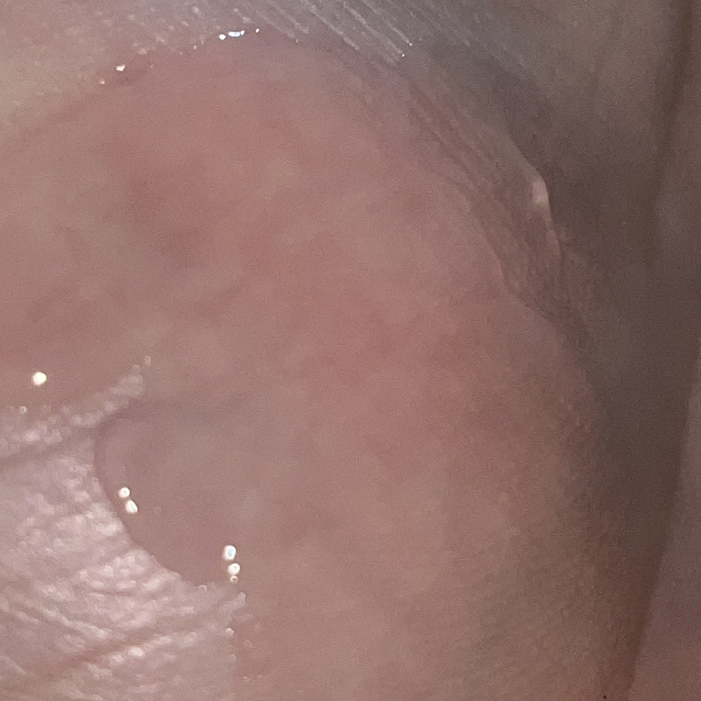 红色冰沙精华 30的真实用户使用照片