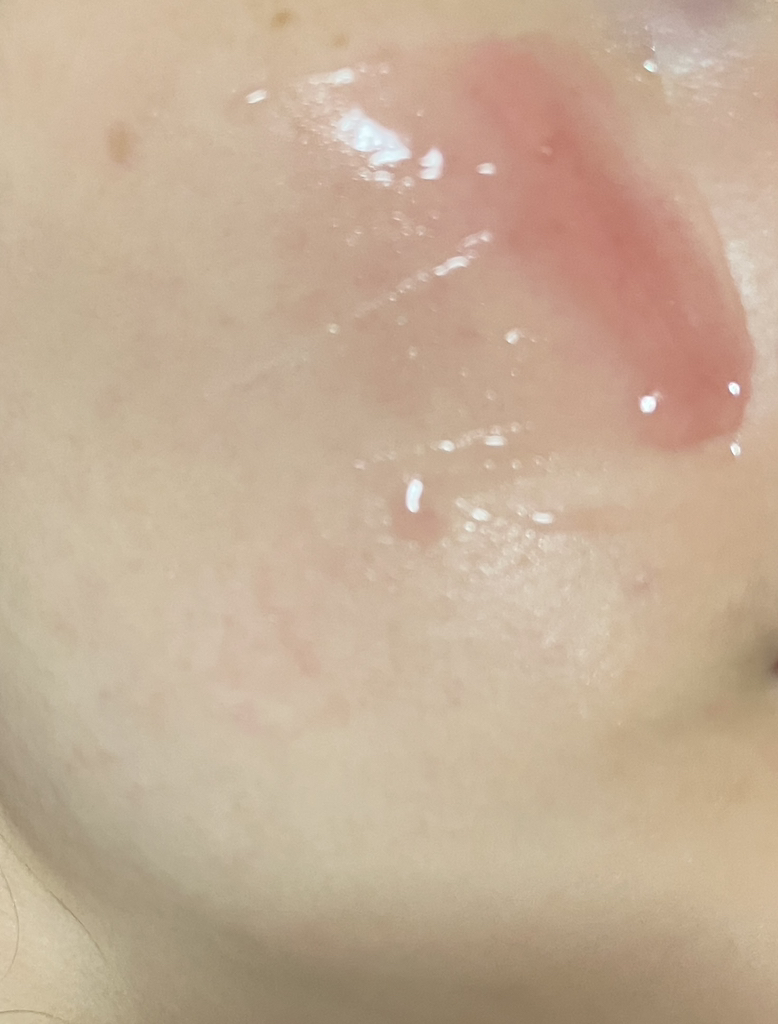 红色冰沙精华 30的真实用户使用照片
