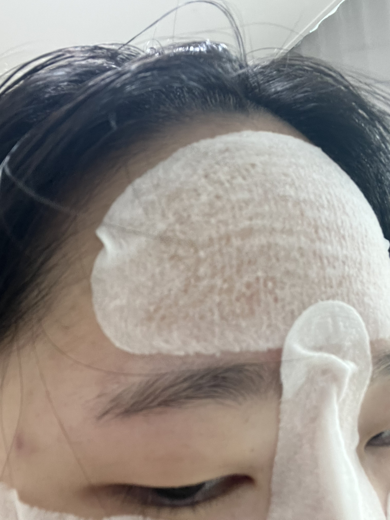 irecipe 西卡 PDRN 跟踪透明碳粉垫 common.review image