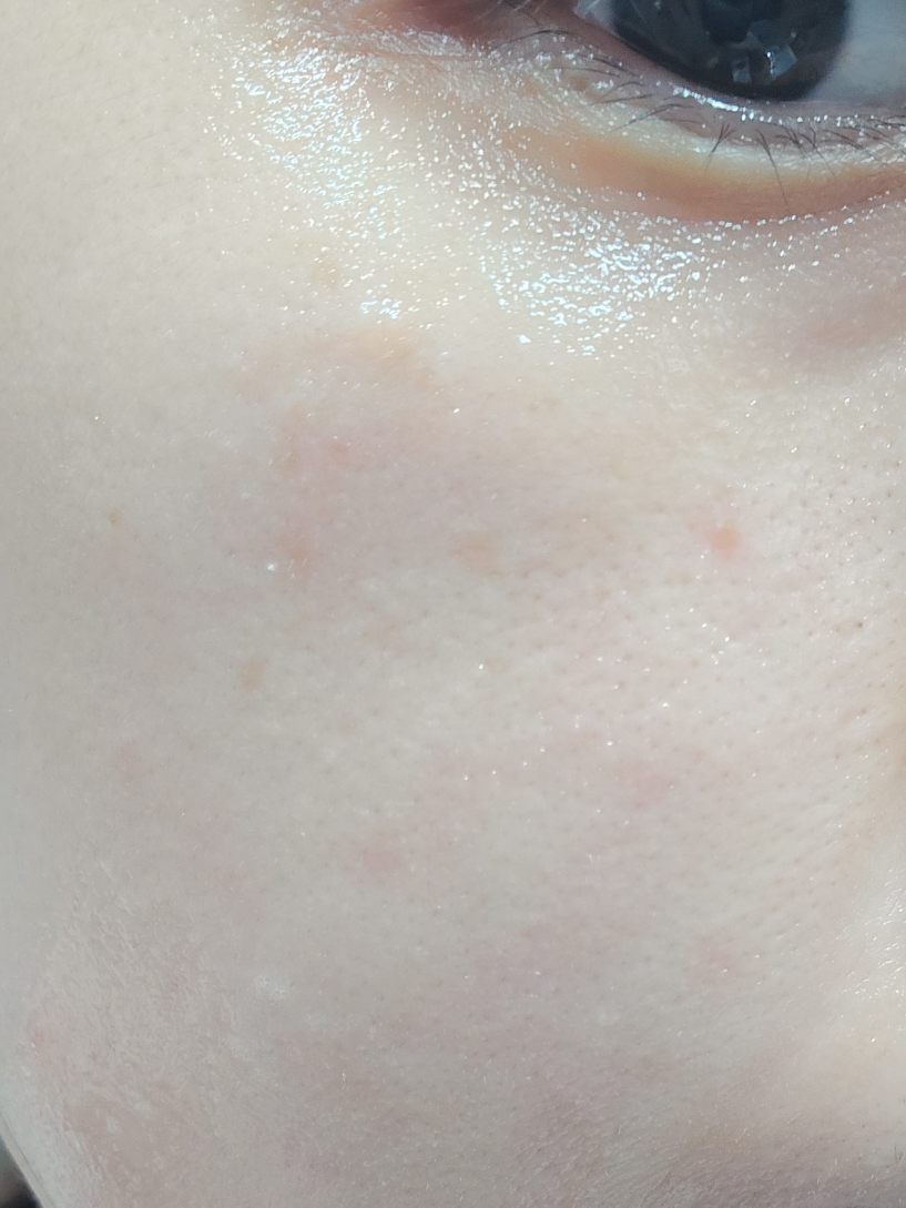 真正透明质酸一日护理套装的真实用户使用照片