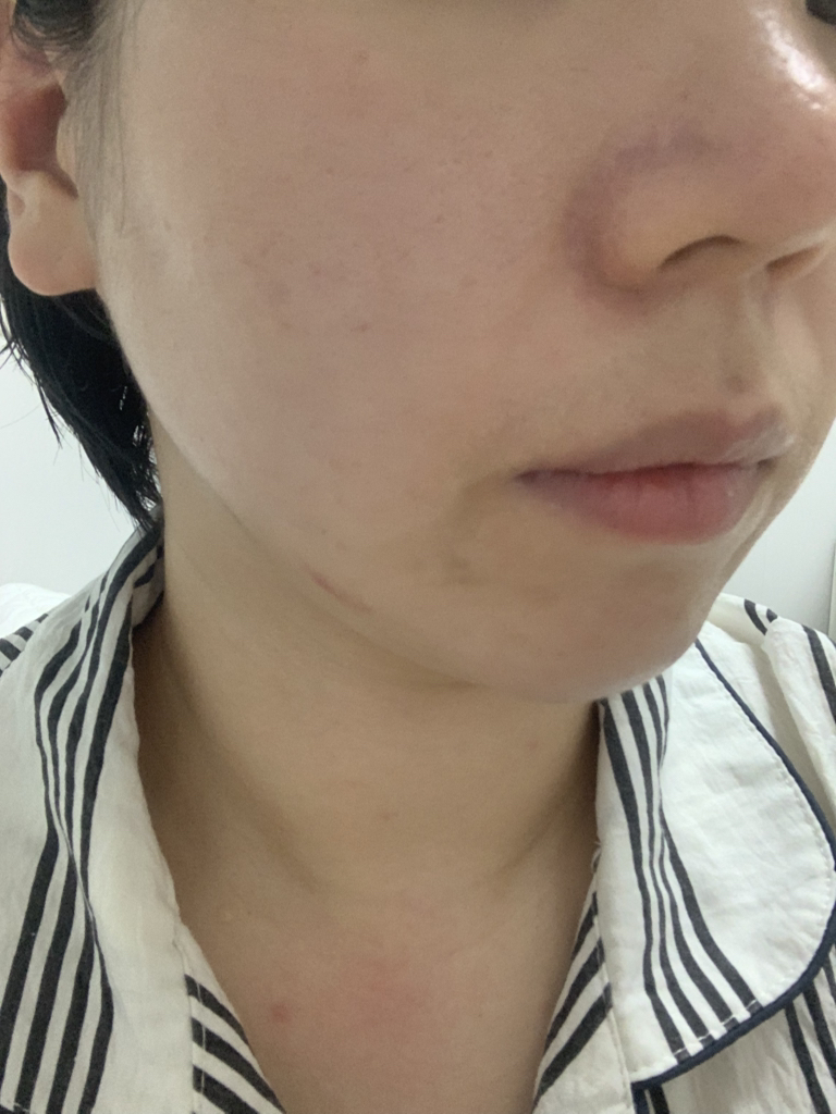 绿豆毛孔紧致舒缓霜的真实用户使用照片