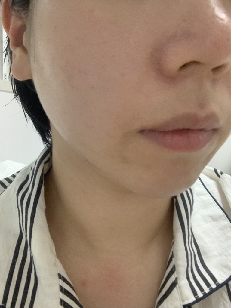 绿豆毛孔紧致舒缓霜的真实用户使用照片
