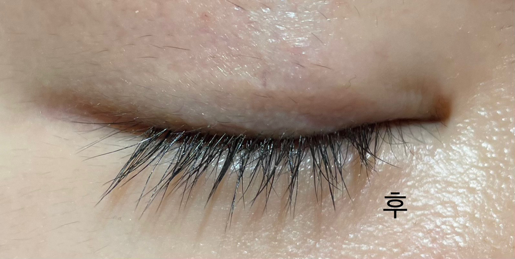 雷菲尔德 细胞因子睫毛双安瓿瓶 common.review image