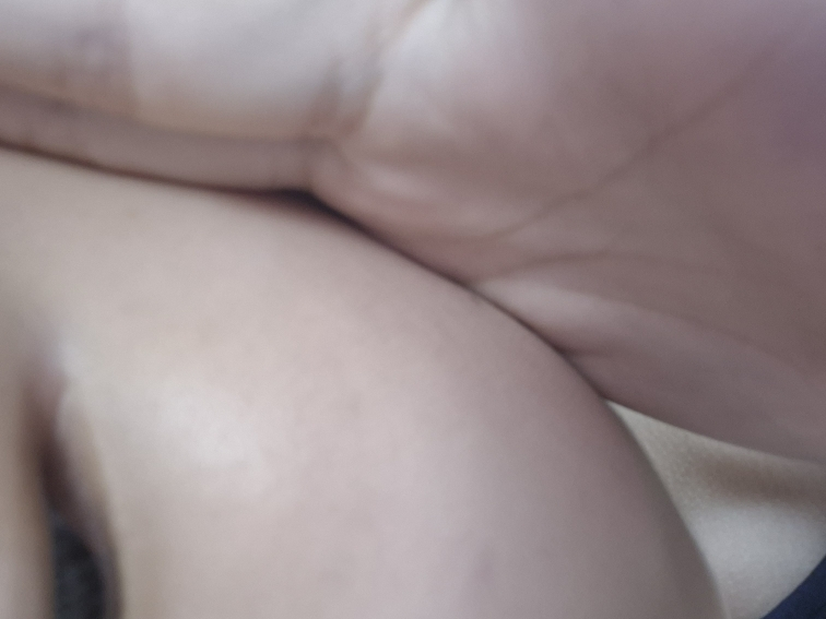 瑷丝特兰 阿托贝利尔365乳霜 common.review image