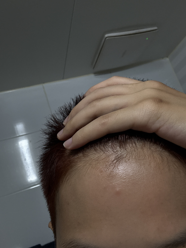 安宇安 鱼腥草槲皮素醇™毛孔深层清洁泡沫 common.review image