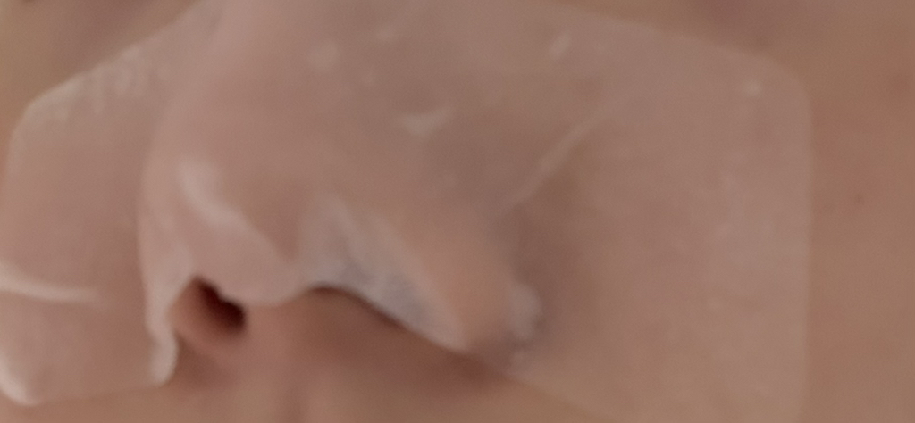 黑头溶解透明鼻贴的真实用户使用照片