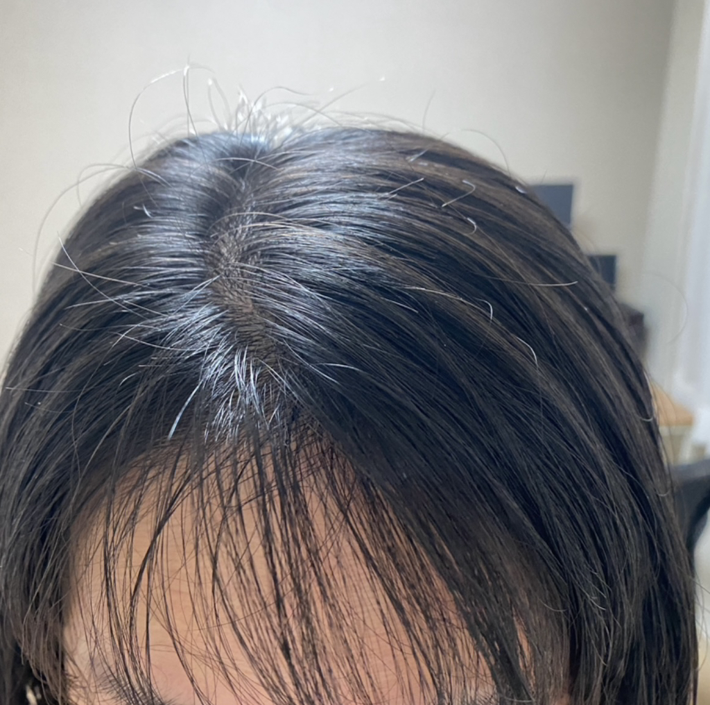 닥터방기원 (Dr.Banggiwon) 랩 탈모샴푸 review image