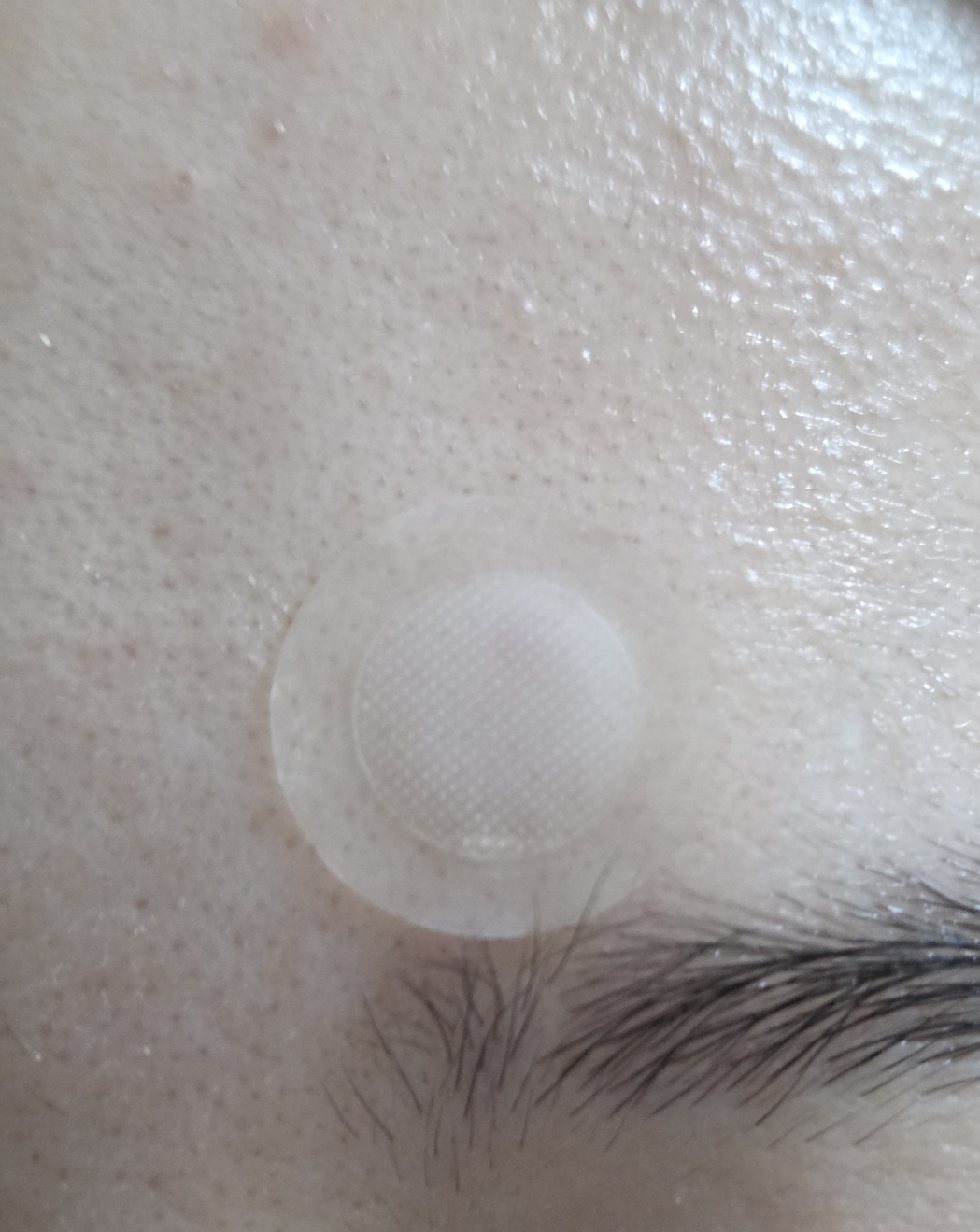 일루미엘 (illumiel+) 마이크로니드샷 엑소좀 스팟 패치 review image