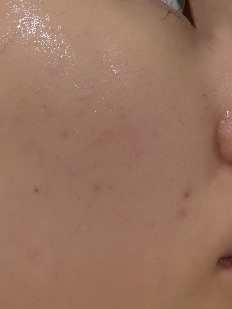 아이레시피 (irecipe) 시카 PDRN 흔적 클리어 세럼 review image