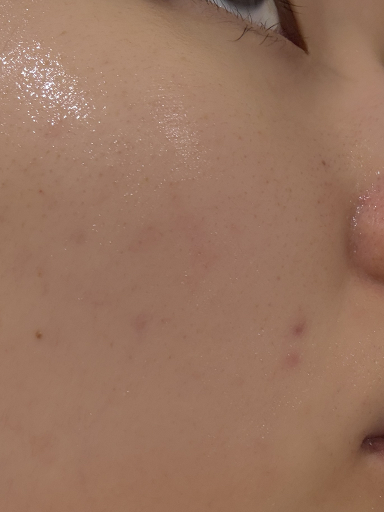 아이레시피 (irecipe) 시카 PDRN 흔적 클리어 크림 review image