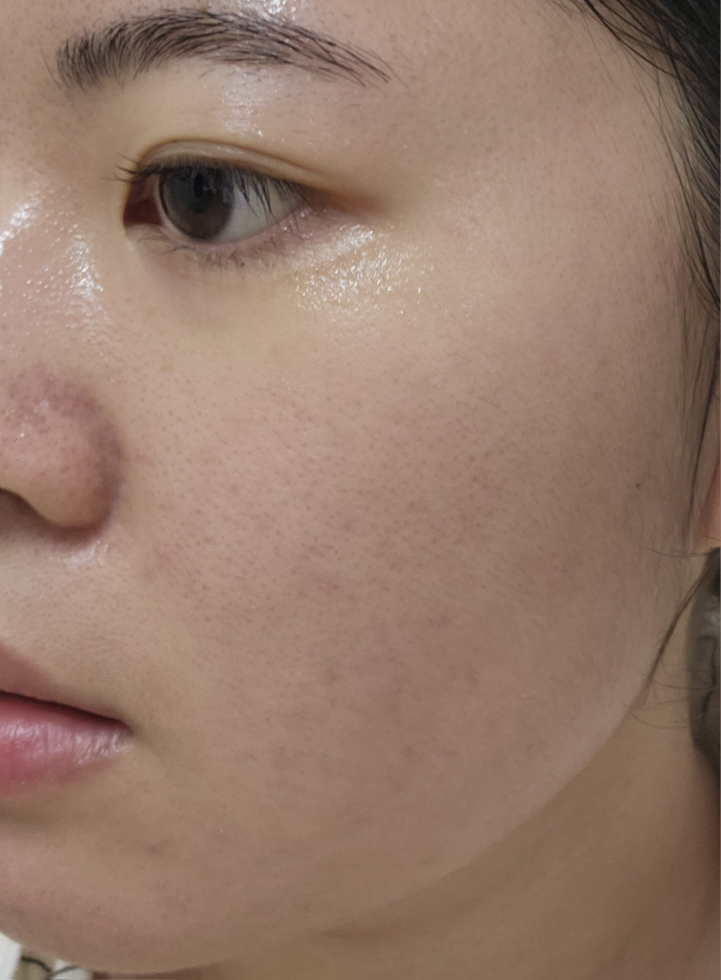果达儿 温和面膜 [茶树增益] common.review image