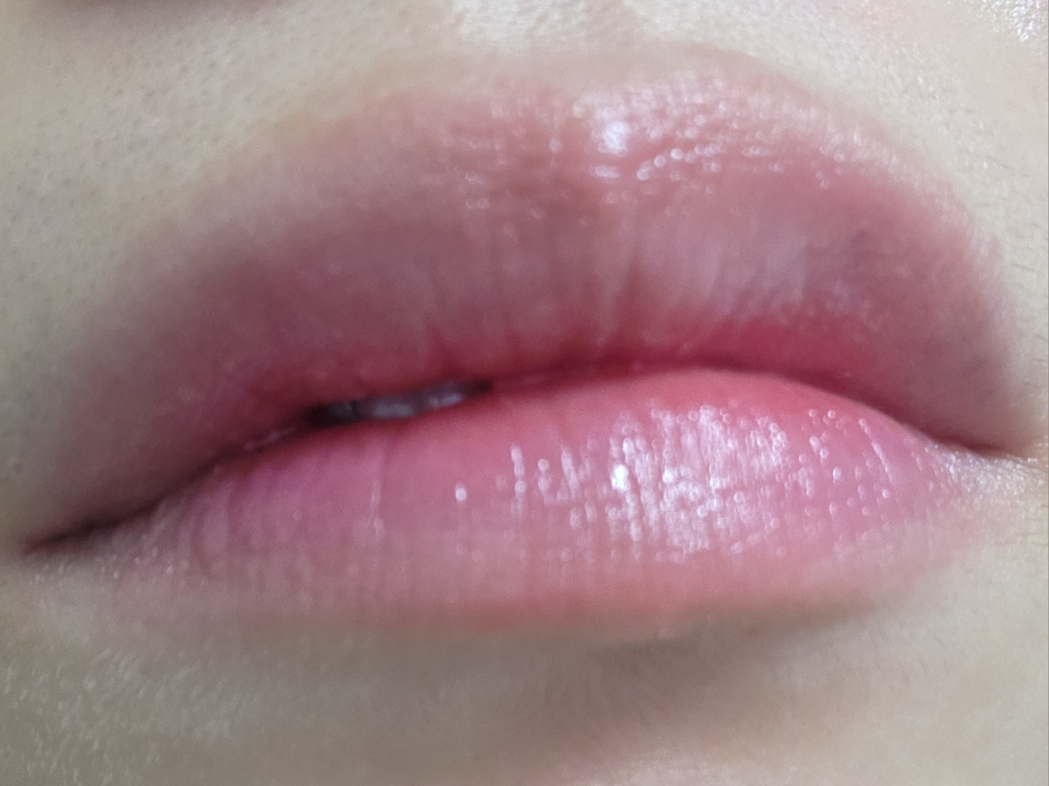 1025 独岛洁肤水的真实用户使用照片