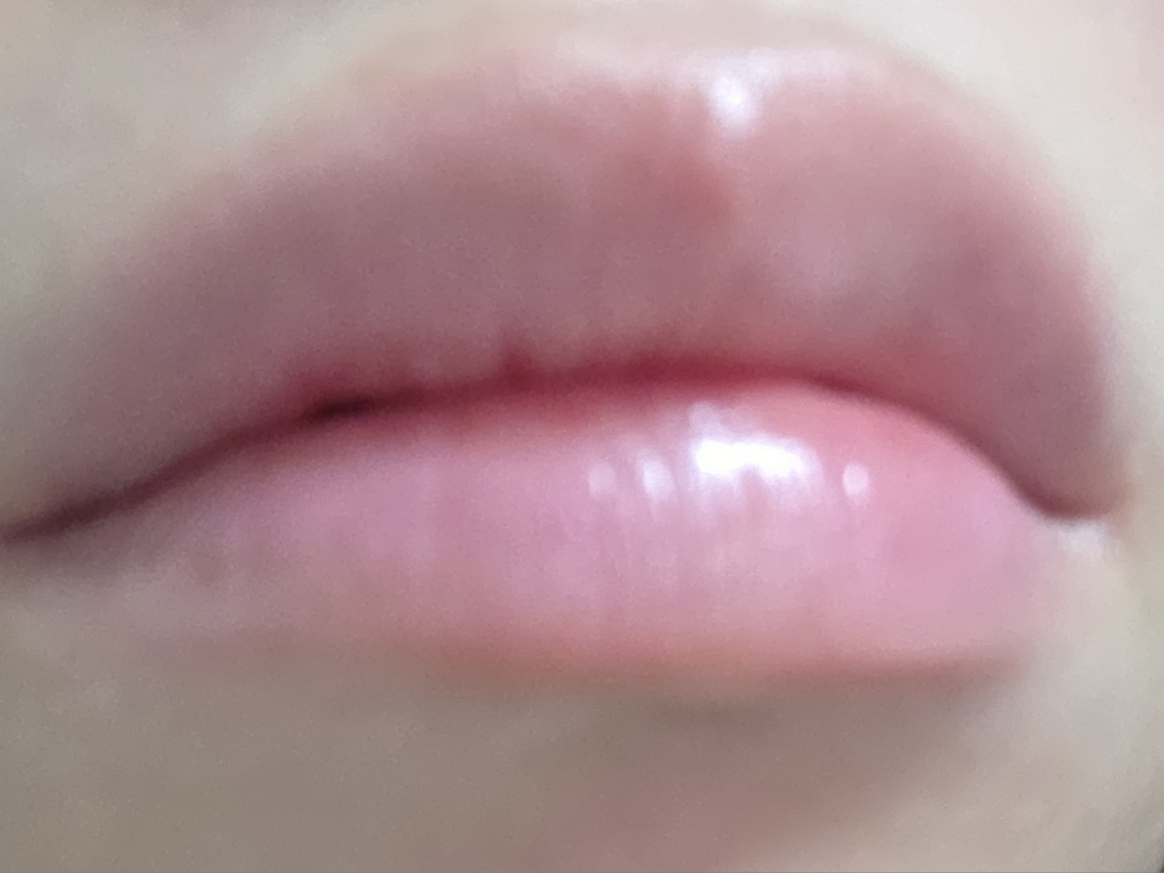 1025 独岛洁肤水的真实用户使用照片